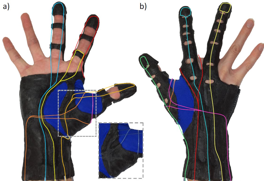 Figure — FLEXotendon Glove-III: Soft Robotic Hand Rehabilitation Exoskeleton for Spinal Cord Injury