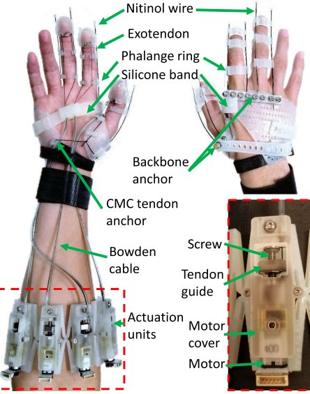 Figure — Patient-specific, Voice-controlled, Robotic FLEXotendon Glove-II System for Spinal Cord Injury